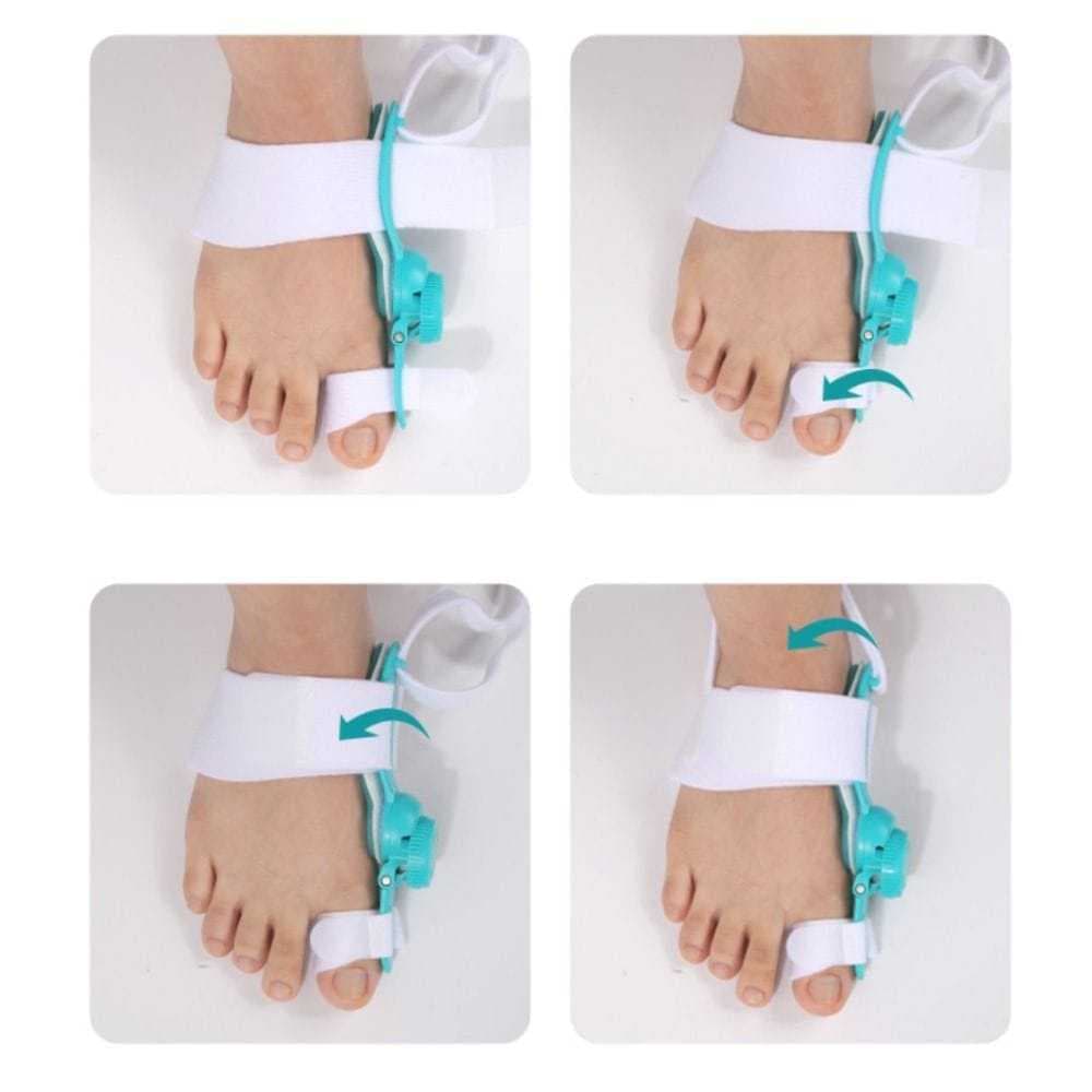 Alat Korektor Jempol Jari Kaki Bengkok Pelurus Penyangga Jempol Kaki Corrector Bunion Hallux Valgus K-Puter
